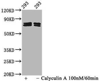 PAK4/PAK5/PAK6 Antibody