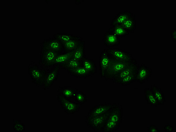 PAK4/PAK5/PAK6 Antibody