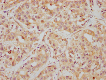 HDAC6 Antibody