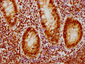 CDC5L Antibody