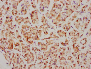 CDC5L Antibody