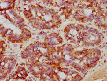 NDRG1 Antibody