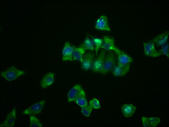 NDRG1 Antibody