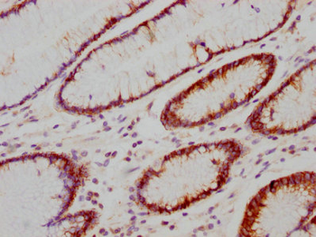 CA9 Antibody