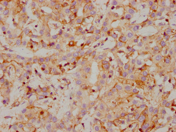 CA9 Antibody