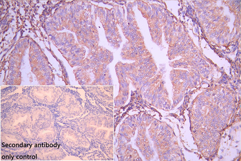 BAK1 Antibody