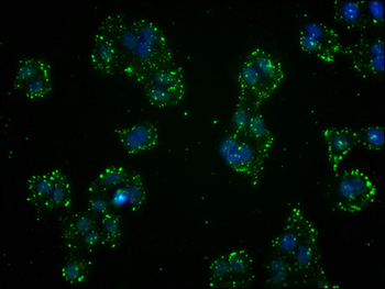 GSTO1 Antibody