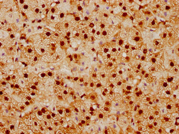 SUMO1 Antibody