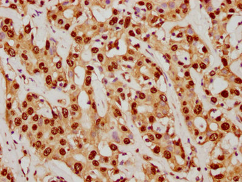 SUMO1 Antibody