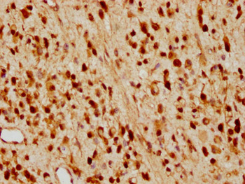 CDKN1B Antibody