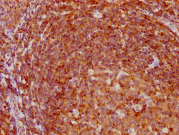 CDKN1B Antibody