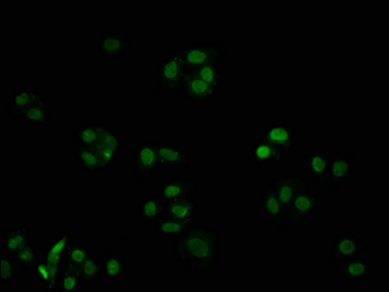 CDKN1B Antibody
