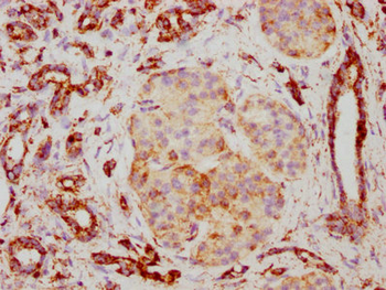 TSPO Antibody