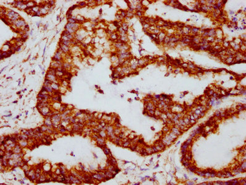 TSPO Antibody