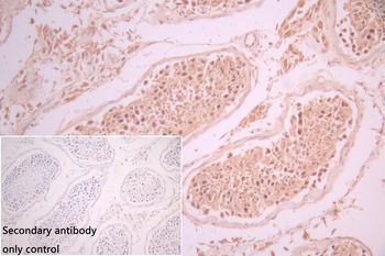 CDC25C Antibody