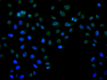 CDC25C Antibody