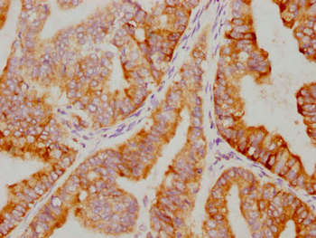 NFKBIA Antibody
