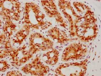 ATF4 Antibody