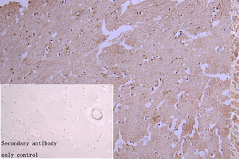 HNRNPC Antibody