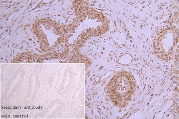 HNRNPC Antibody