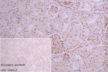 HNRNPC Antibody