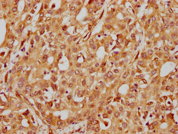 ITGB1 Antibody
