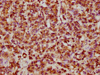 HSPB1 Antibody