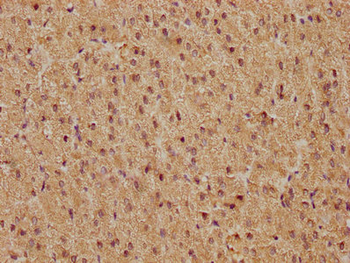 FOS Antibody