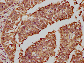 FOS Antibody