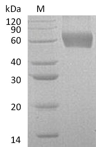 Human CSF2RA protein