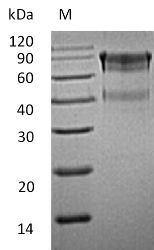 Mouse IL15RA protein