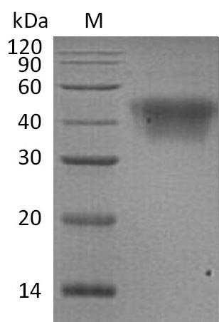 Human FCGR3A protein