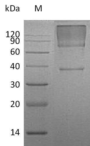 Human GPC3 protein