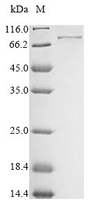 Aves Acrosin protein