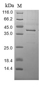 Human ALPP protein