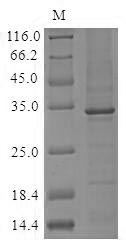 Human C1QA protein