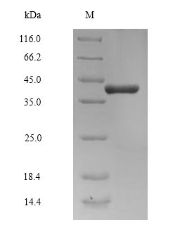Human CCNK protein