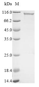 Human CILP protein