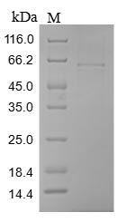 Human CILP protein
