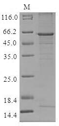 Human CTSO protein
