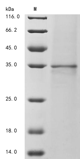 Rat Entpd1 protein