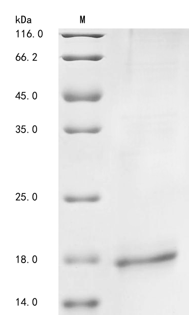 Human GIPR protein
