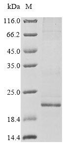 Human GJA1 protein