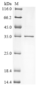 Human HAPLN2 protein