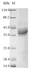 Mouse Mxd1 protein