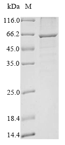 Human NPEPPS protein