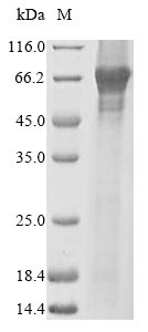 Human PPARA protein