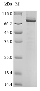 Human PTPRT protein