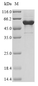 Human RORA protein