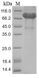 Human RPSA protein